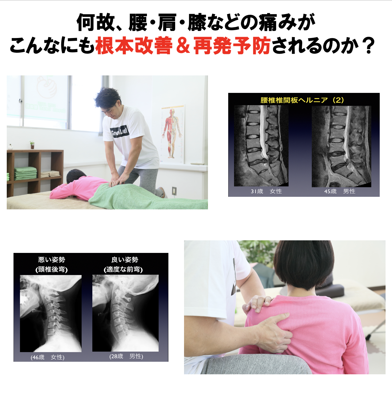 改善